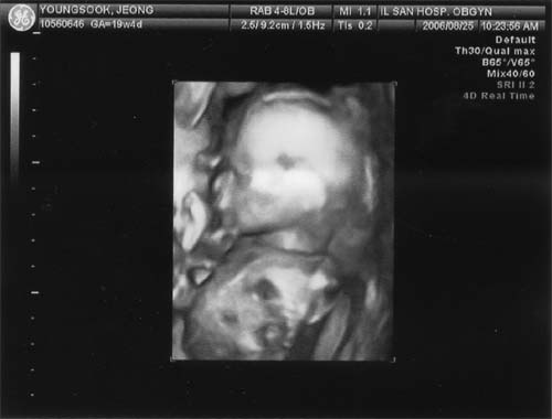 왼쪽아이.jpg